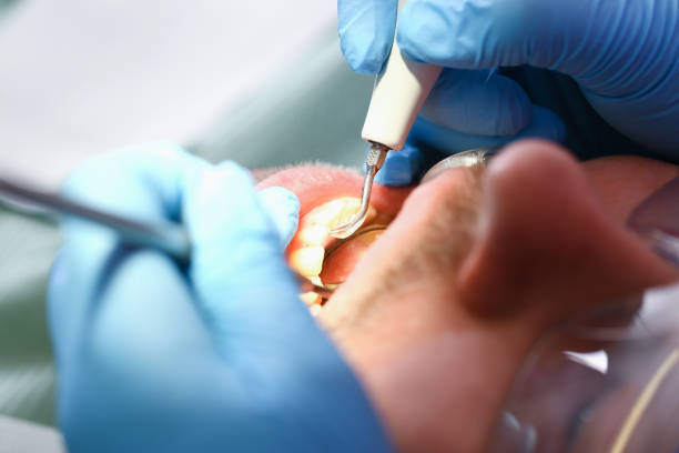 Best Broken or Chipped Tooth Repair in Edgemere, MD